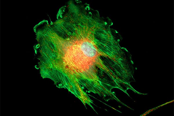 Fluorescence microscopy image showing cell and nucleous - representing life science market