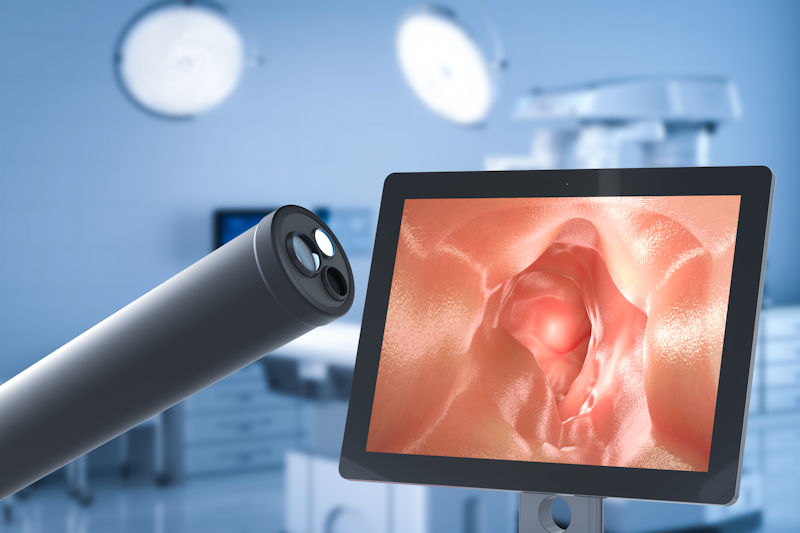 The tip of an endoscope next to a monitor