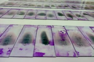 Microscope slides ready for scanning