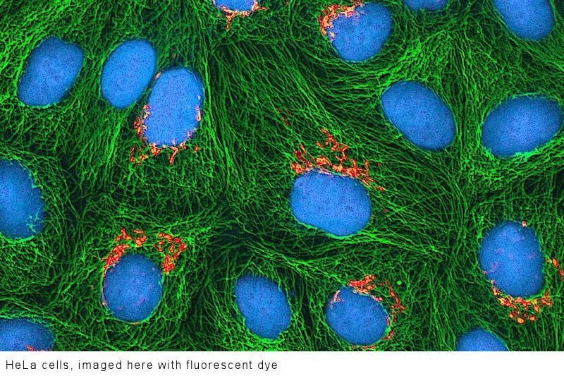 HeLa cells imaged with fluorescent dye